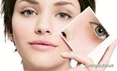 激光祛咖啡斑价格详解，美容领域激光技术的应用与价格表解析